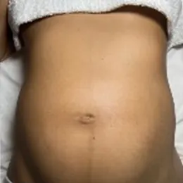 Prenatal & Postpartum Lymphatic Drainage at Just For You Bodywork & Massage